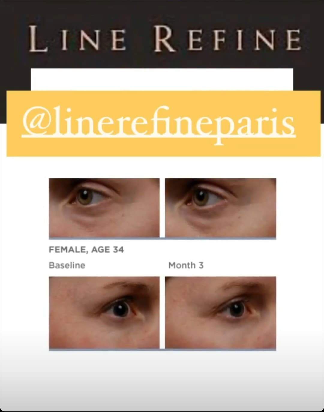 Patchs cernes et sourire - LINEREFINE - Line Refine